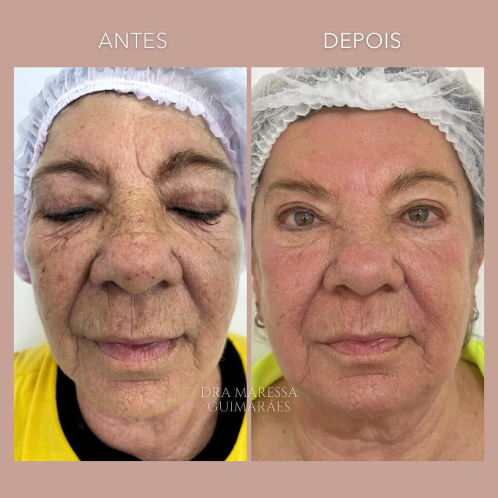 Estética Facial Clinica de Estetica Vila Maria Mah Guimaraes